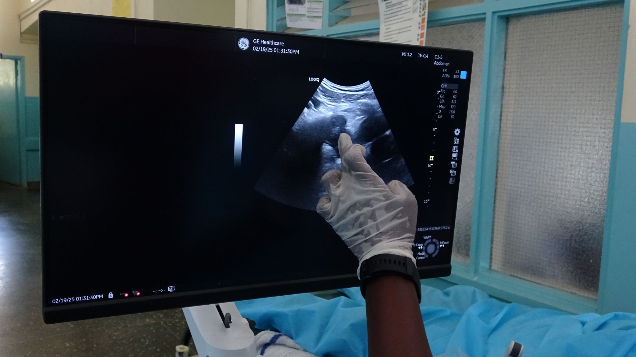 Kakamega Bronchoscopy Camp clinical team